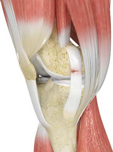Knee Ligament Injuries Treatment Northwood | ACL Tear Uxbridge | PCL