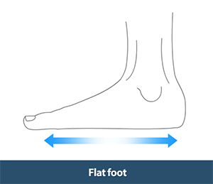 Foot Examination Northwood | Foot Surgery Uxbridge | Ankle Specialist ...